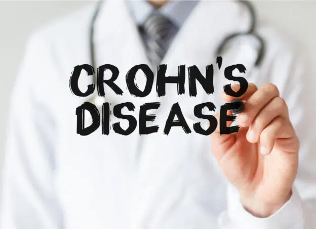 Chrohn's Disease