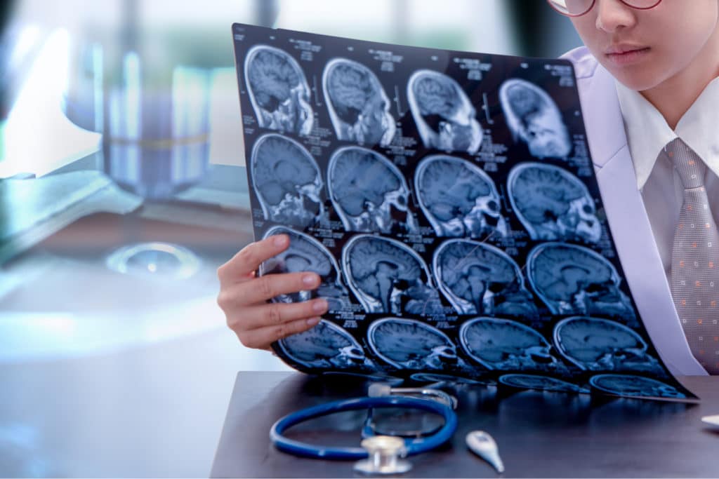 Doctor in white coat reviewing brain MRI scan films, stethoscope on desk, traumatic brain injury evaluation