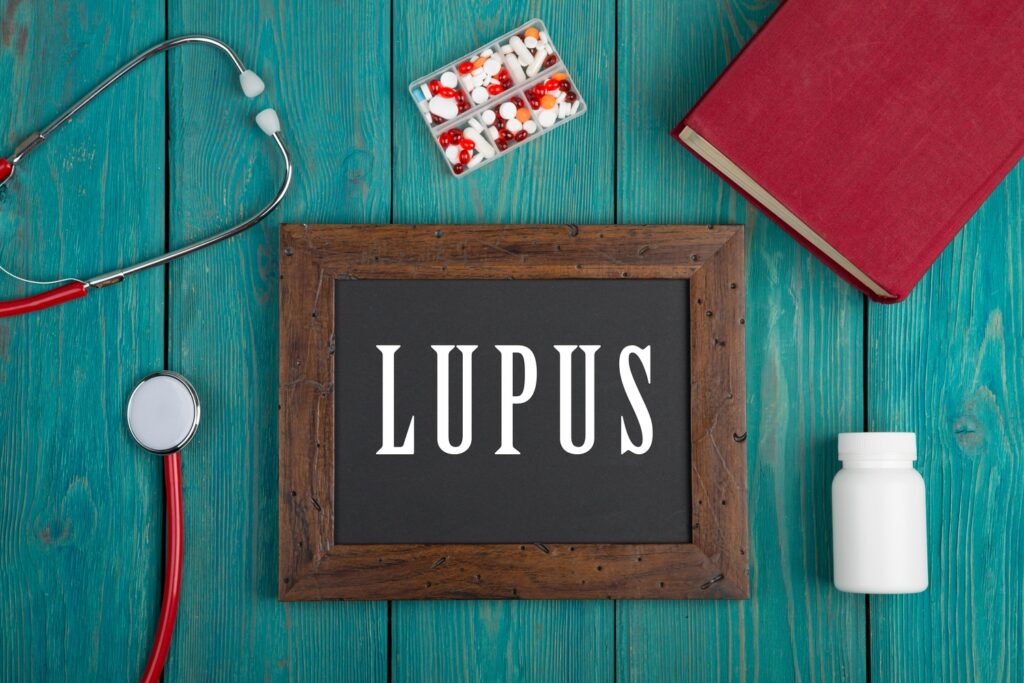 Chalkboard sign reading "Lupus" surrounded by a stethoscope, pill organizer, medication bottle, and red medical book on teal wood surface