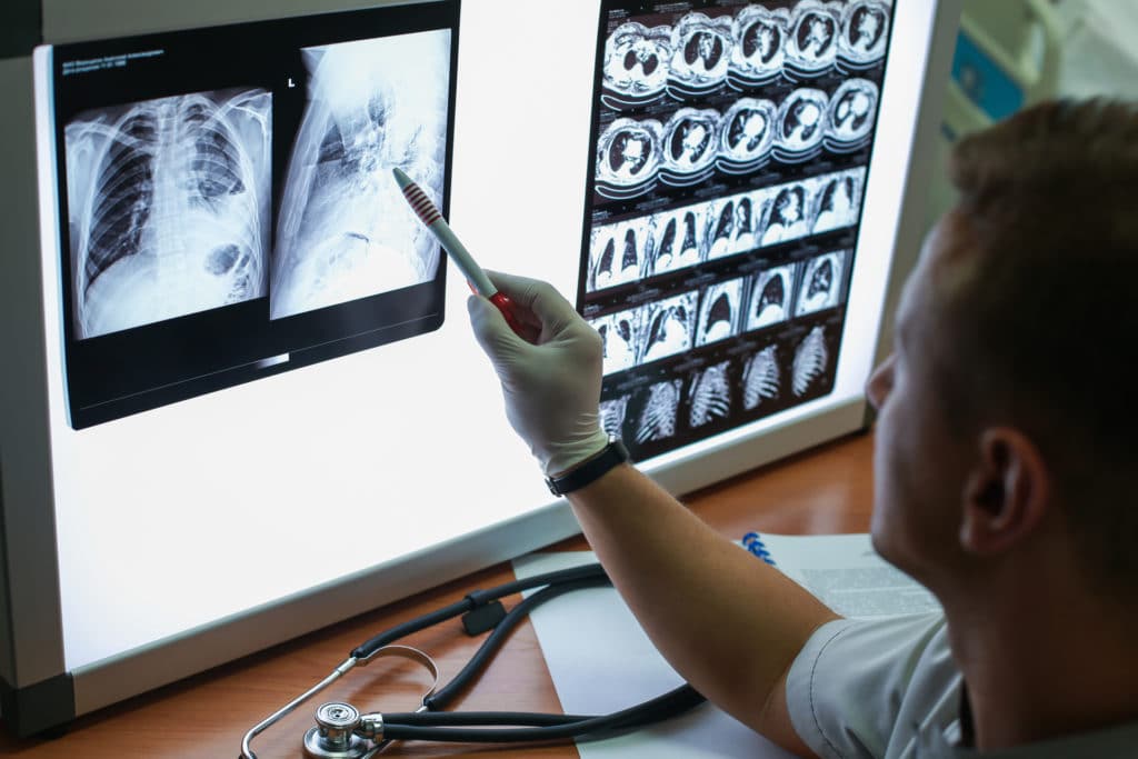 Doctor in gloves pointing to chest X-rays and CT scan images on a lightbox during medical review